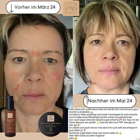 SKIN-LOVE - Wildrosen Serum mit Aloe Vera & Hyaluron Bio-Naturkosmetik 100m - VITALOVE - Naturprodukte